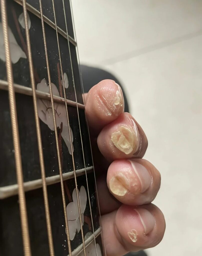 Bouts de doigts d'un guitariste marqués par la pratique